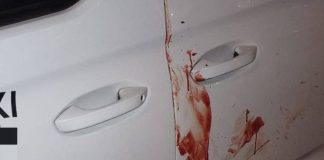 Un taxista herido tras recibir 16 puñaladas en Sevilla Un taxista herido tras recibir 16 puñaladas en Sevilla