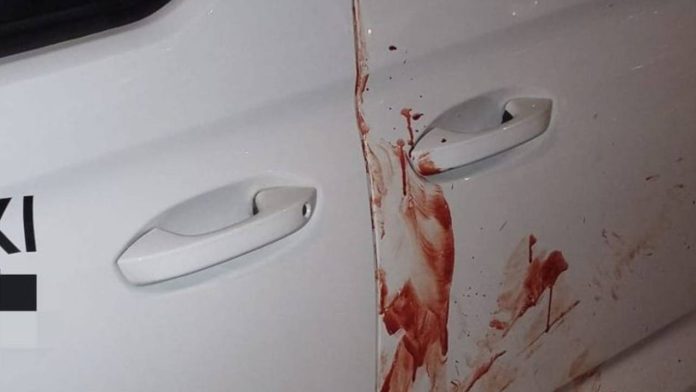 Un taxista herido tras recibir 16 puñaladas en Sevilla Un taxista herido tras recibir 16 puñaladas en Sevilla